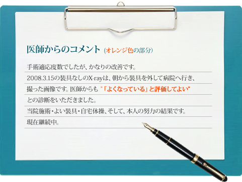 医師からのコメント(オレンジ色の部分)：手術適応度数でしたが、かなりの改善です。
2008.3.15の装具なしのX-rayは、朝から装具を外して病院へ行き、 
撮った画像です。医師からも ”「よくなっている」と評価してよい” 
との診断をいただきました。
当院施術・よい装具・自宅体操、そして、本人の努力の結果です。
現在継続中。